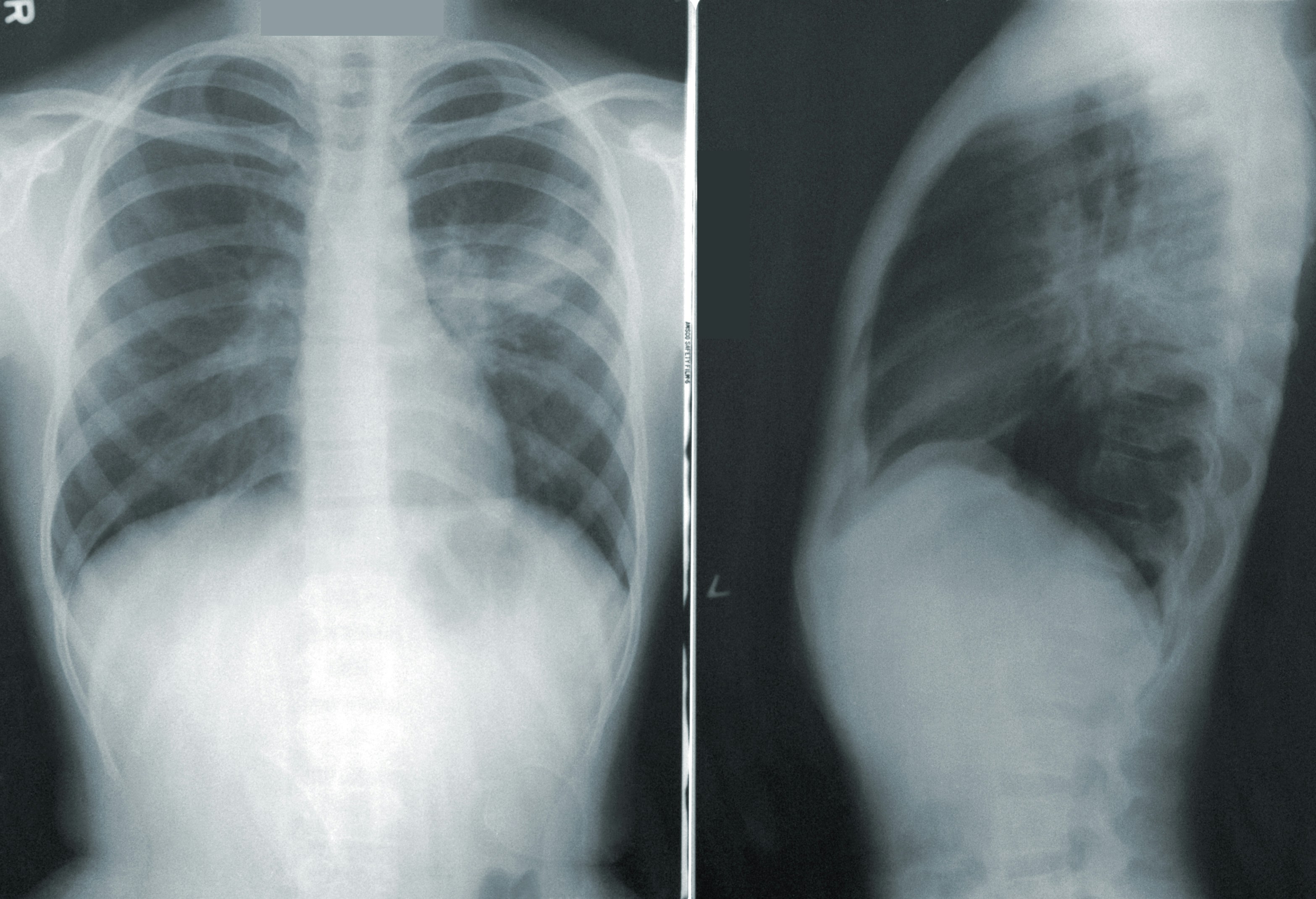 medical imaging